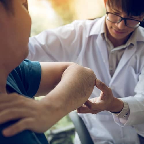 Visitor Insurance for Arthritis
